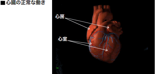 不整脈 徐脈性不整脈 頻脈性不整脈 致死性不整脈 心不全がよくわかる 心不全 Com 日本メドトロニック株式会社